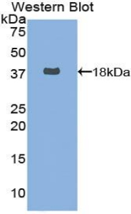 Polyclonal Antibody to Fatty Acid Synthase (FASN)