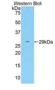 Polyclonal Antibody to Fatty Acid Synthase (FASN)