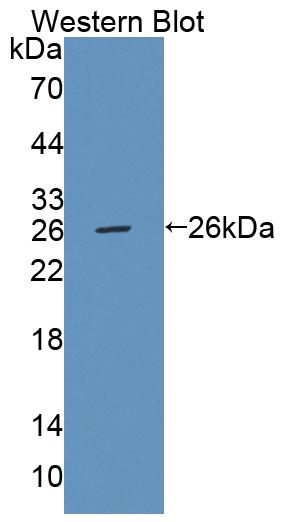 PAC471Hu01.jpg