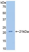 Polyclonal Antibody to Fibulin 1 (FBLN1)