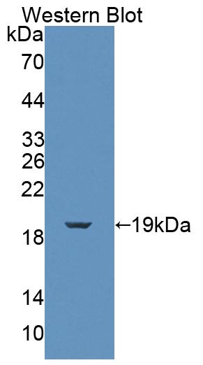 PAC479Hu01.jpg