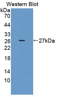 Polyclonal Antibody to Follicular Lymphoma Variant Translocation 1 (FVT1)