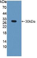 Polyclonal Antibody to Guanidinoacetate-N-Methyltransferase (GAMT)