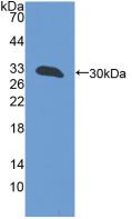 Polyclonal Antibody to G-Elongation Factor, Mitochondrial 1 (GFM1)