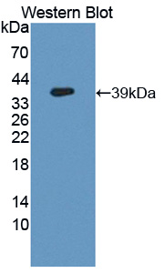 Polyclonal Antibody to Prostate-specific Membrane Antigen (PMSA)