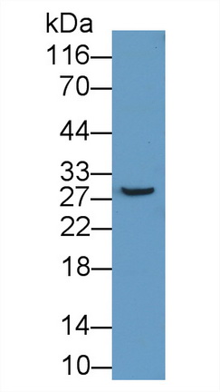 PAC521Hu01.jpg