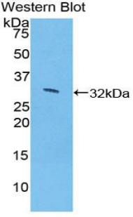 Polyclonal Antibody to Janus Kinase 1 (JAK1)