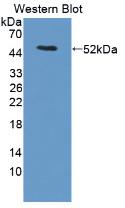 PAC576Hu01.jpg