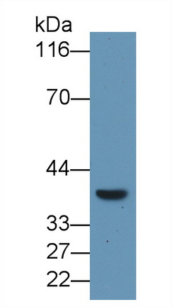 PAC615Hu01.jpg