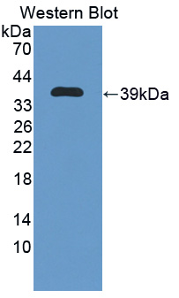 PAC704Hu01.jpg