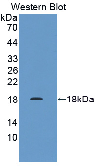 PAC722Hu01.jpg