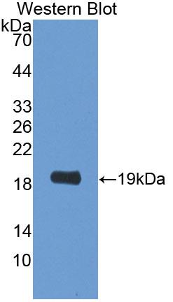 Polyclonal Antibody to Phospholipid Transfer Protein (PLTP)