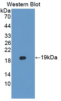 Polyclonal Antibody to Phospholipid Transfer Protein (PLTP)