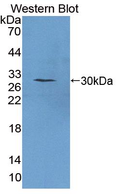 Polyclonal Antibody to Pituitary Tumor Transforming 1 (PTTG1)