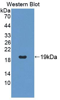 Polyclonal Antibody to T-Cell Lymphoma Invasion And Metastasis Inducing Protein 1 (TIAM1)