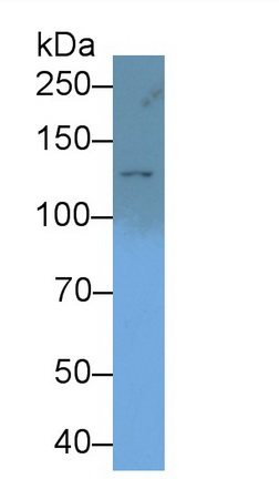 Polyclonal Antibody to Tuberous Sclerosis Protein 1 (TSC1)