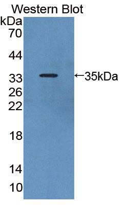 PAC824Hu01.jpg