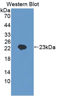 Polyclonal Antibody to Sciellin (SCEL)