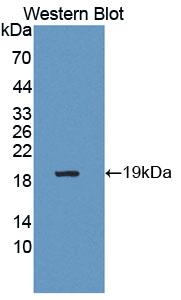 PAC845Hu01.jpg