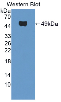 Polyclonal Antibody to Smoothelin (SMTN)