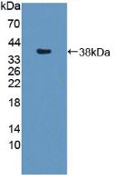 Polyclonal Antibody to Syntrophin Beta 1 (SNTb1)