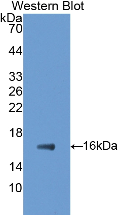 Polyclonal Antibody to Glutamate Decarboxylase 1, Brain (GAD1)