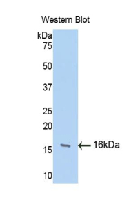 Polyclonal Antibody to Fibroblast Growth Factor 13 (FGF13)