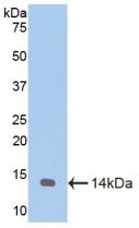 Polyclonal Antibody to Melatonin Receptor 1A (MTNR1A)