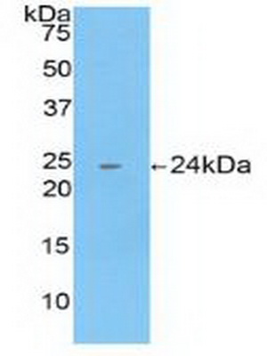 PAC964Hu01.jpg