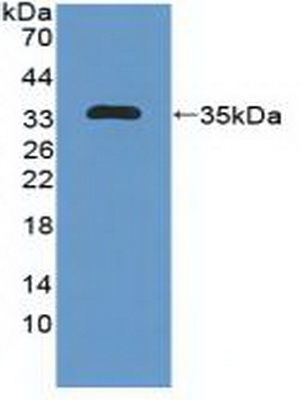 PAC975Hu01.jpg