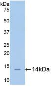 Polyclonal Antibody to Carcinoembryonic Antigen Related Cell Adhesion Molecule 1 (CEACAM1)