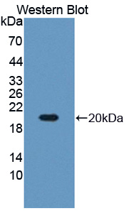 PAC997Hu01.jpg