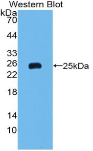 Polyclonal Antibody to Ferritin, Heavy Polypeptide (FTH)