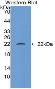 Biotin-Linked Polyclonal Antibody to Ferritin, Heavy Polypeptide (FTH)