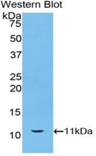 Polyclonal Antibody to Heat Shock 70kDa Protein 8 (HSPA8)