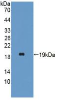 Polyclonal Antibody to Hemoglobin Alpha 1 (HBa1)