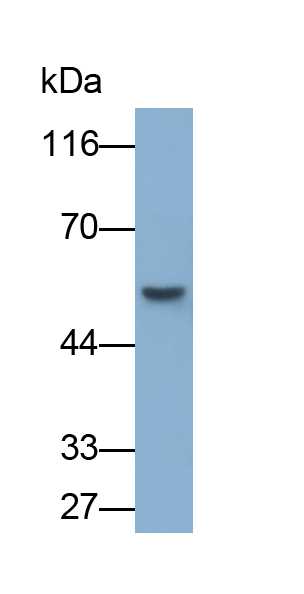 Polyclonal Antibody to Mucin 21 (MUC21)