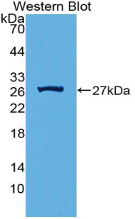 Polyclonal Antibody to Complement Component 1, Q Subcomponent A (C1qA)