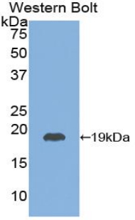 Polyclonal Antibody to Thyroid Stimulating Hormone Beta (TSHb)