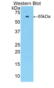 Polyclonal Antibody to Troponin C Type 2, Fast (TNNC2)