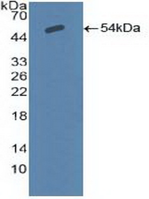 Polyclonal Antibody to Amiloride Sensitive Sodium Channel Subunit Alpha (SCNN1a)