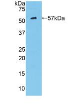 Polyclonal Antibody to Hexokinase 2 (HK2)