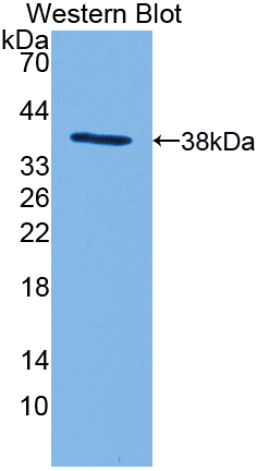 PAD435Mu01.jpg