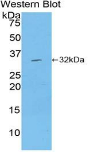 Polyclonal Antibody to Mitogen Activated Protein Kinase Kinase 7 (MAP2K7)