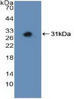 Polyclonal Antibody to Mitogen Activated Protein Kinase Kinase 3 (MAP2K3)