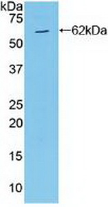 Polyclonal Antibody to Mitogen Activated Protein Kinase Kinase 4 (MAP2K4)