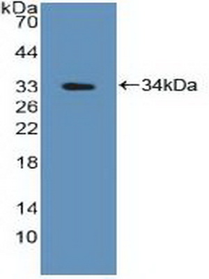 Polyclonal Antibody to Protein Tyrosine Phosphatase, Non Receptor Type 2 (PTPN2)