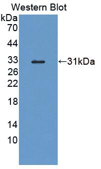 Polyclonal Antibody to Protein Tyrosine Phosphatase, Non Receptor Type 2 (PTPN2)