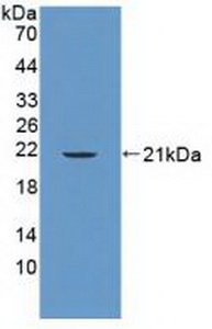 Polyclonal Antibody to Protein Tyrosine Phosphatase, Non Receptor Type 13 (PTPN13)