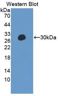 Polyclonal Antibody to Protein Tyrosine Phosphatase, Non Receptor Type 14 (PTPN14)